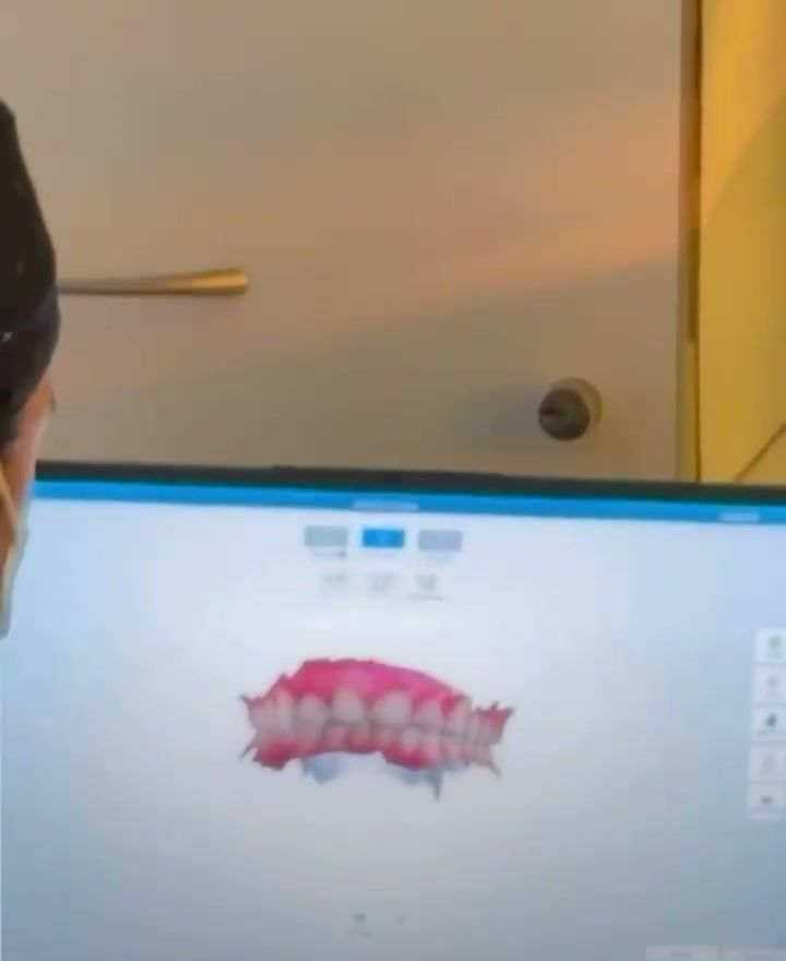 Diseño digital de sonrisa en pantalla